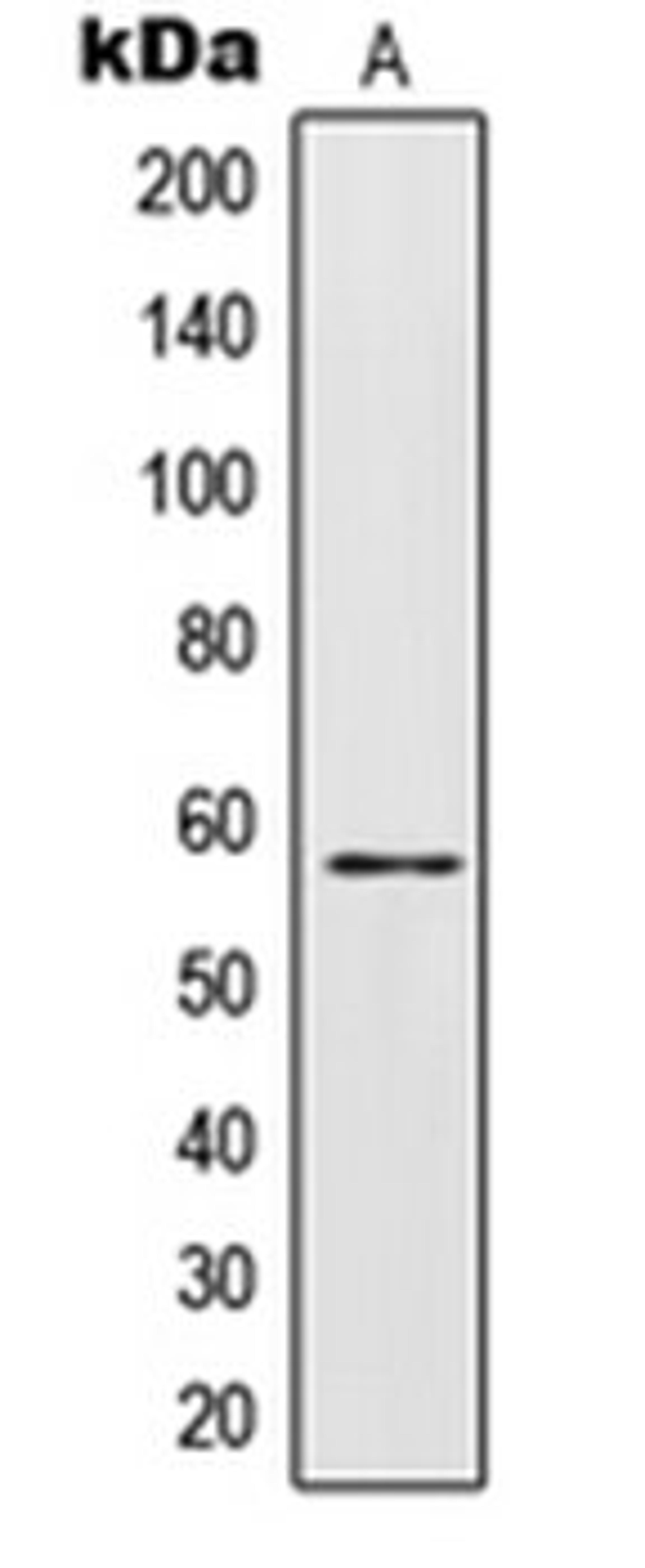 Western blot analysis of HepG2 (Lane 1) whole cell lysates using IL28RA antibody