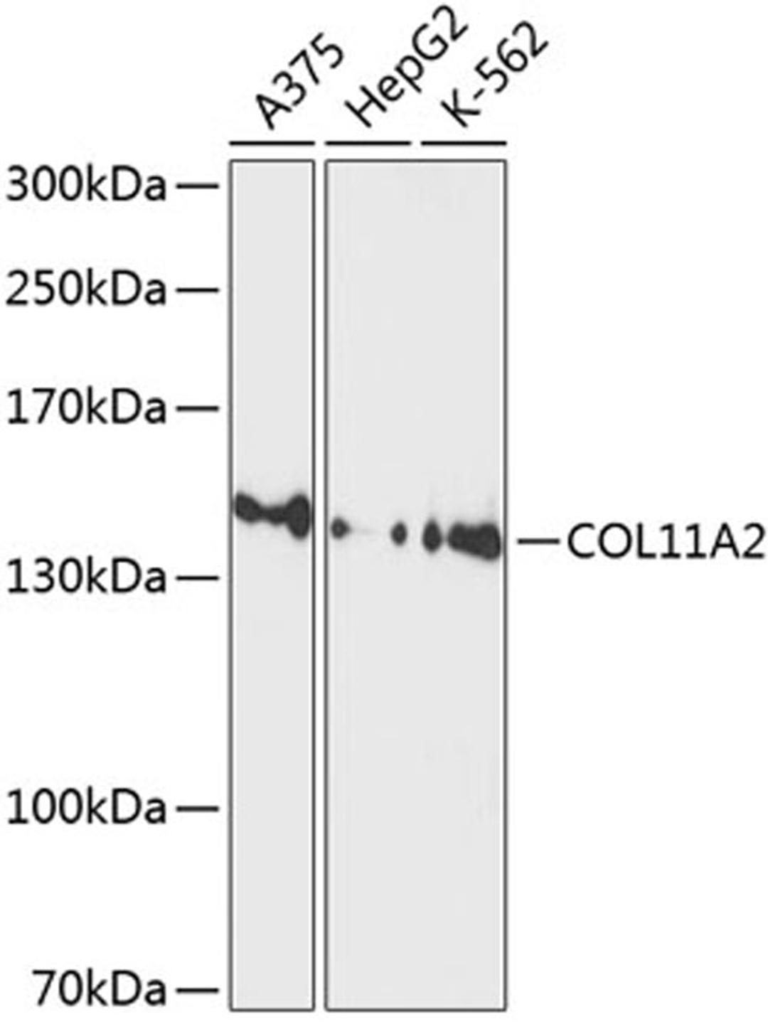 Western blot - COL11A2 antibody (A10473)