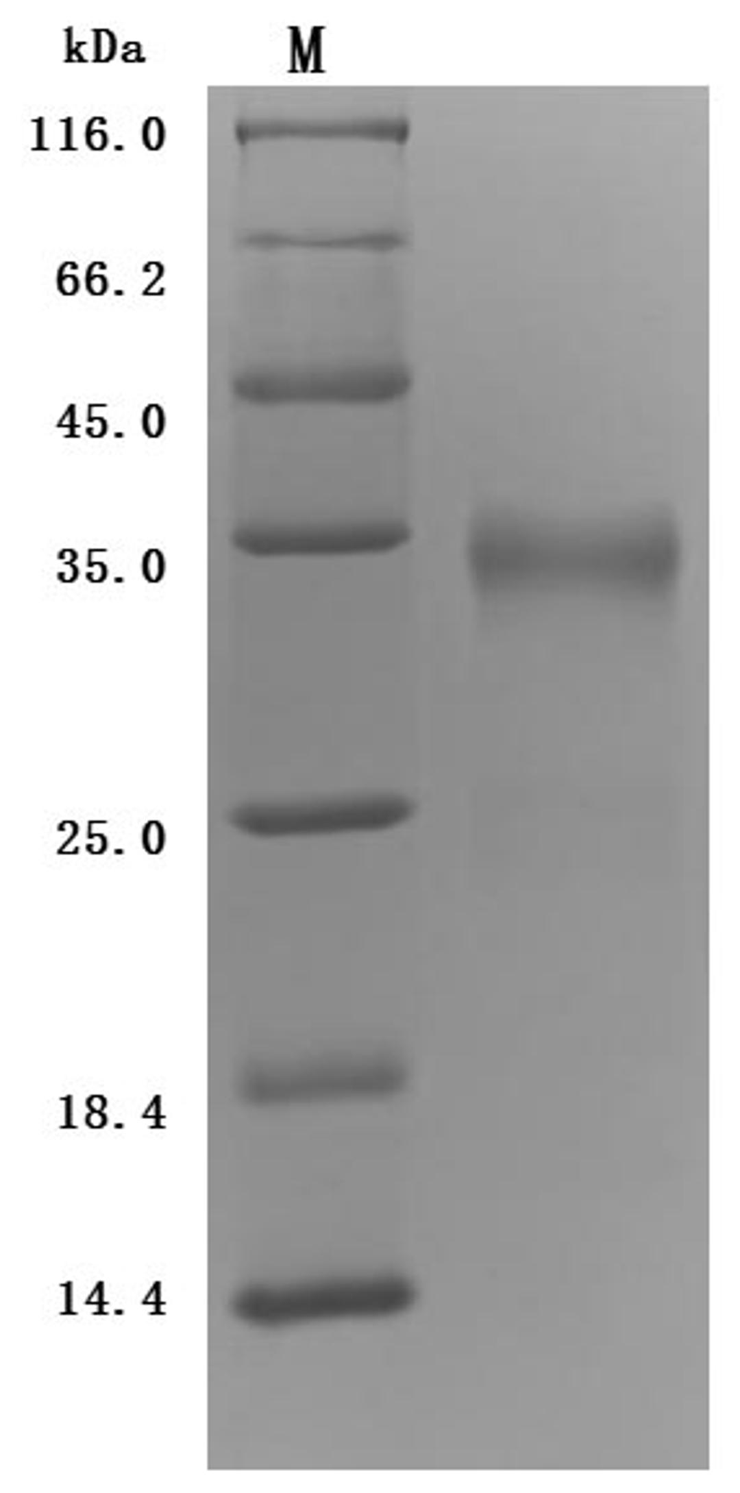 (Tris-Glycine gel) Discontinuous SDS-PAGE (reduced) with 5% enrichment gel and 15% separation gel.