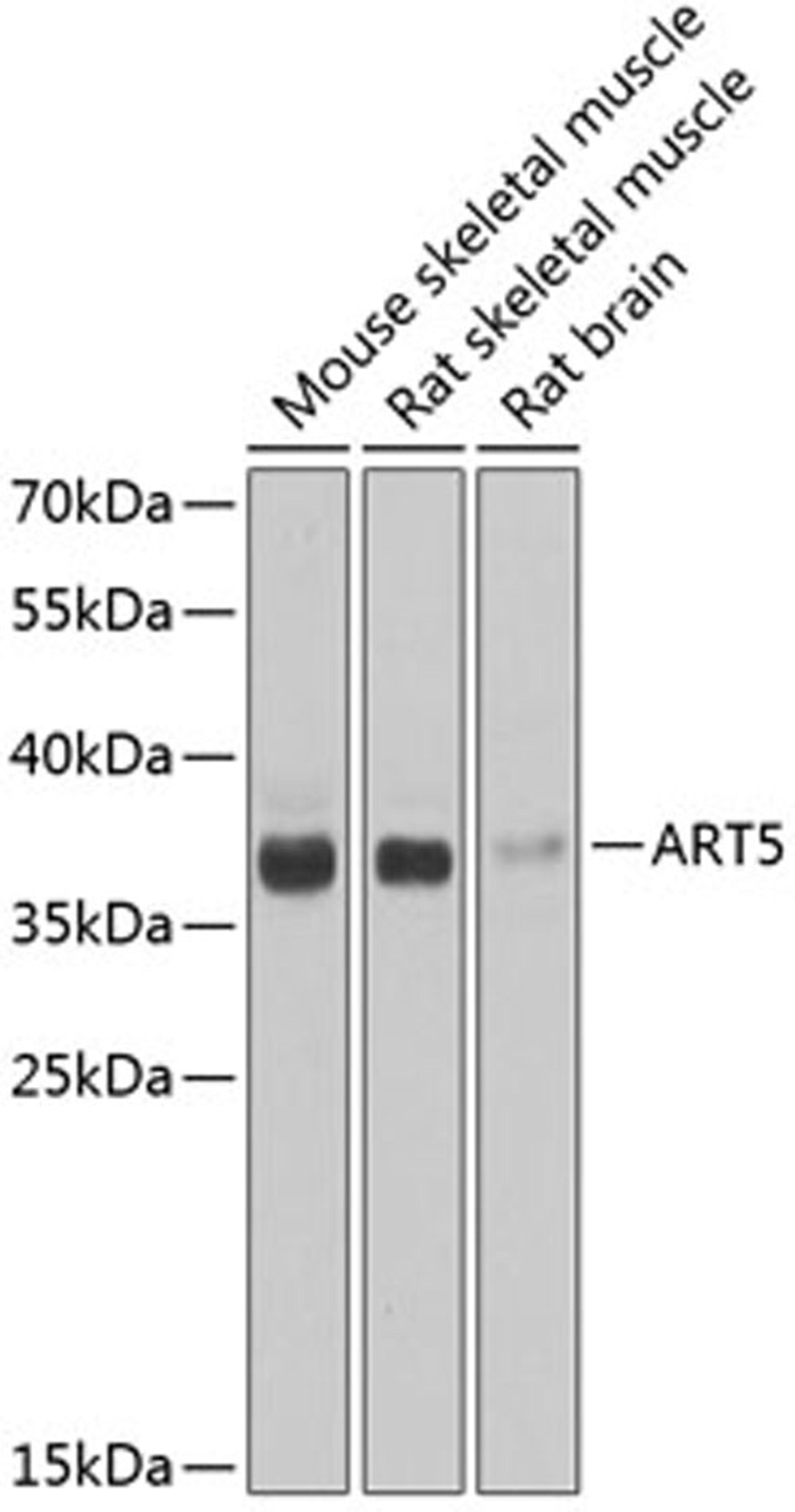 Western blot - ART5 antibody (A7146)