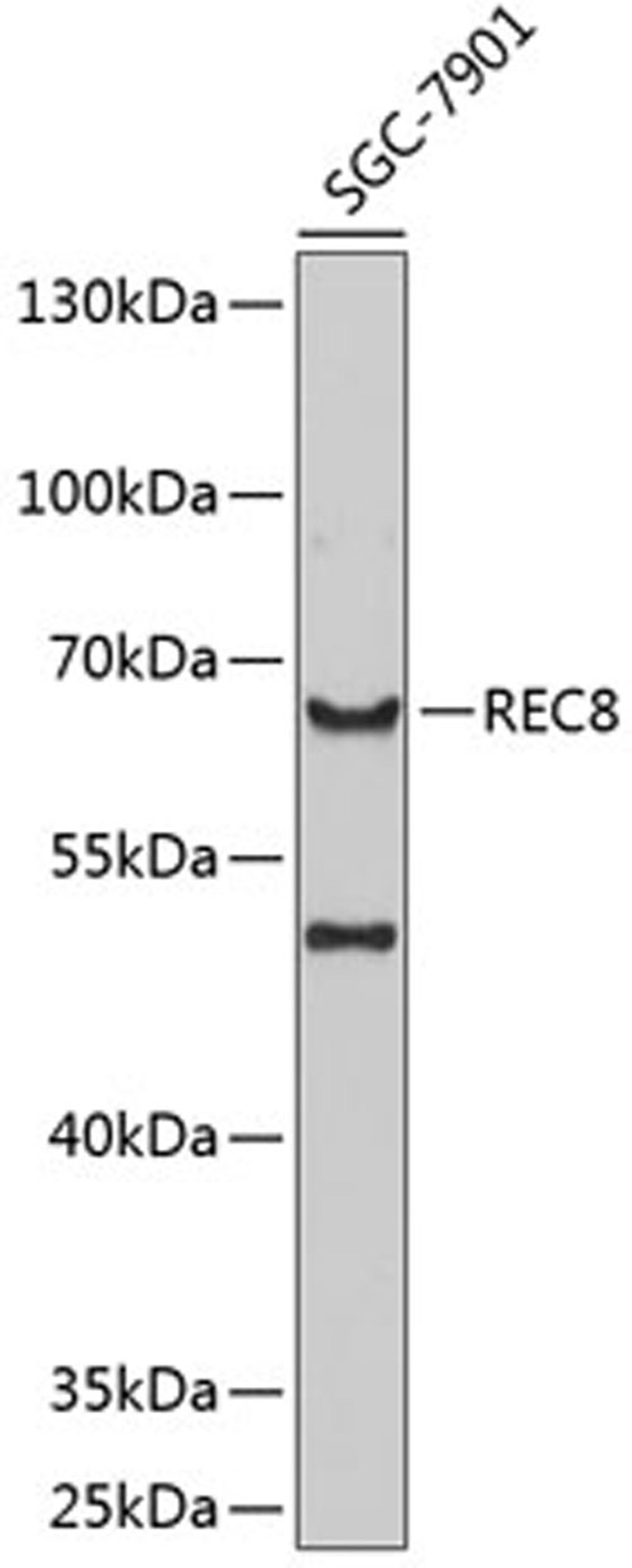 Western blot - REC8 antibody (A8660)