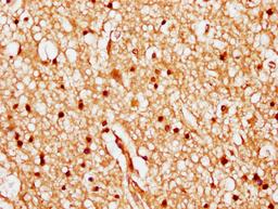 IHC image of CSB-PA010378PA84nhibHU diluted at 1:20 and staining in paraffin-embedded human brain tissue performed on a Leica BondTM system. After dewaxing and hydration, antigen retrieval was mediated by high pressure in a citrate buffer (pH 6.0). Section was blocked with 10% normal goat serum 30min at RT. Then primary antibody (1% BSA) was incubated at 4°C overnight. The primary is detected by a biotinylated secondary antibody and visualized using an HRP conjugated SP system.