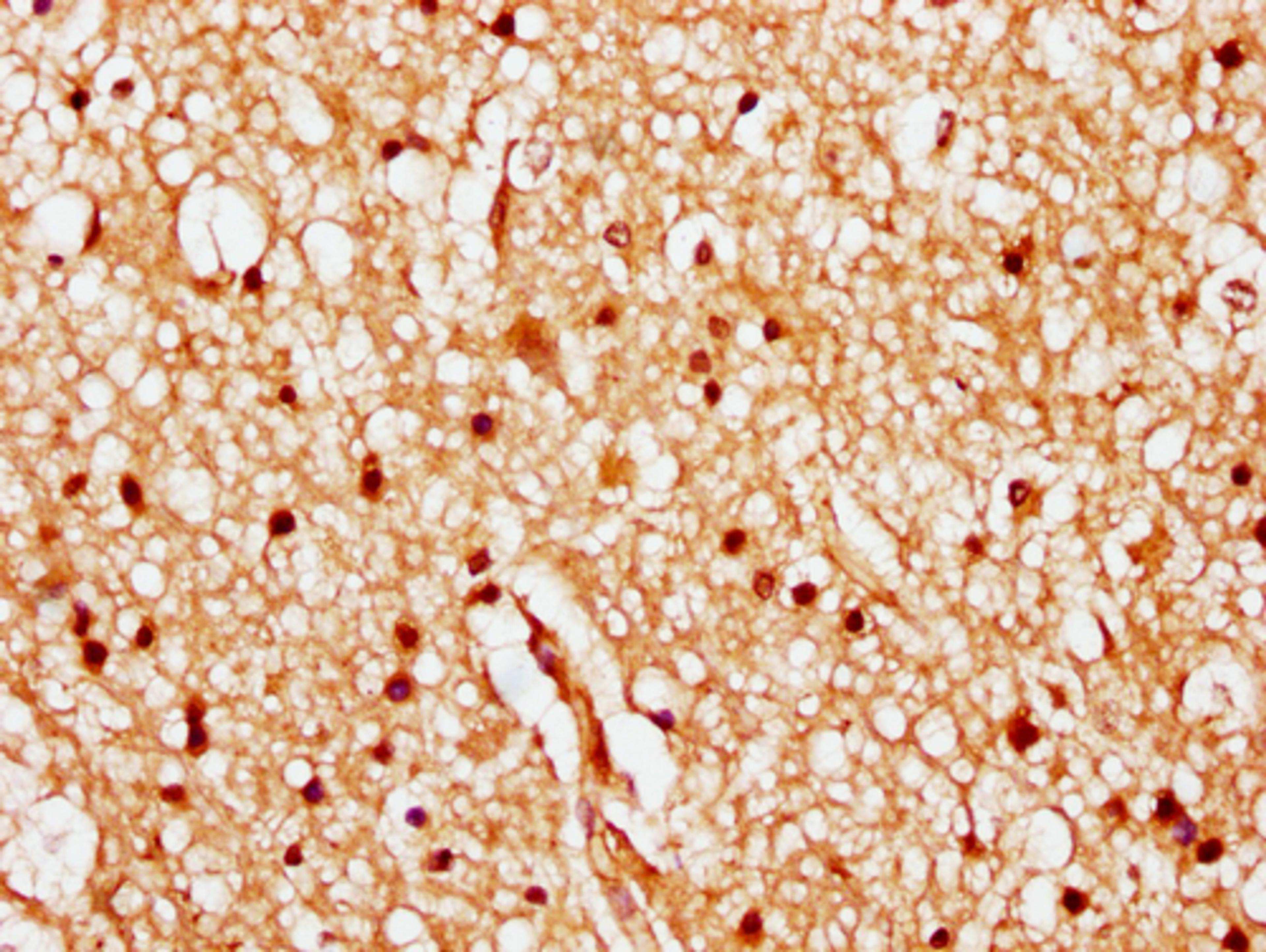 IHC image of CSB-PA010378PA84nhibHU diluted at 1:20 and staining in paraffin-embedded human brain tissue performed on a Leica BondTM system. After dewaxing and hydration, antigen retrieval was mediated by high pressure in a citrate buffer (pH 6.0). Section was blocked with 10% normal goat serum 30min at RT. Then primary antibody (1% BSA) was incubated at 4°C overnight. The primary is detected by a biotinylated secondary antibody and visualized using an HRP conjugated SP system.