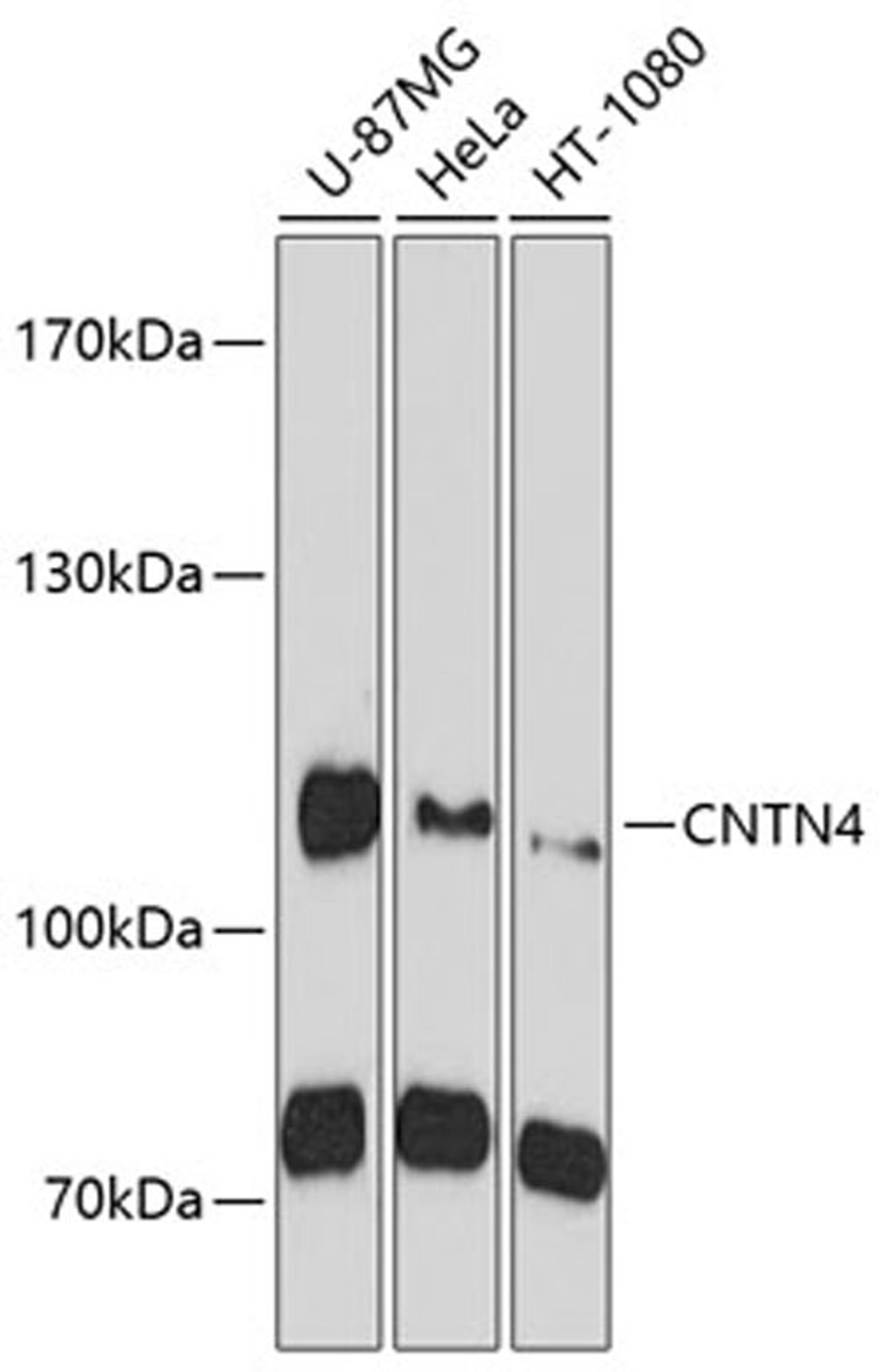 Western blot - CNTN4 antibody (A10339)