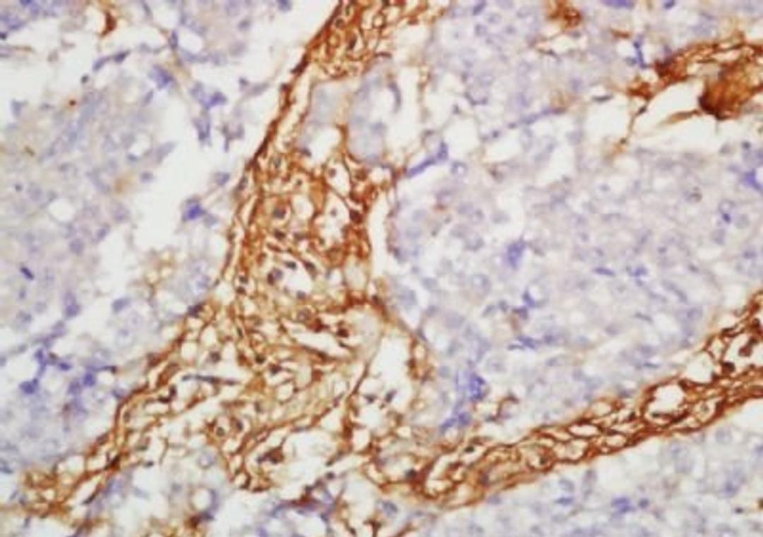 Immunohistochemical analysis of formalin-fixed paraffin embedded rat brain tissue using SLC7A5 antibody (dilution at 1:200)