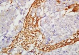 Immunohistochemical analysis of formalin-fixed paraffin embedded rat brain tissue using SLC7A5 antibody (dilution at 1:200)