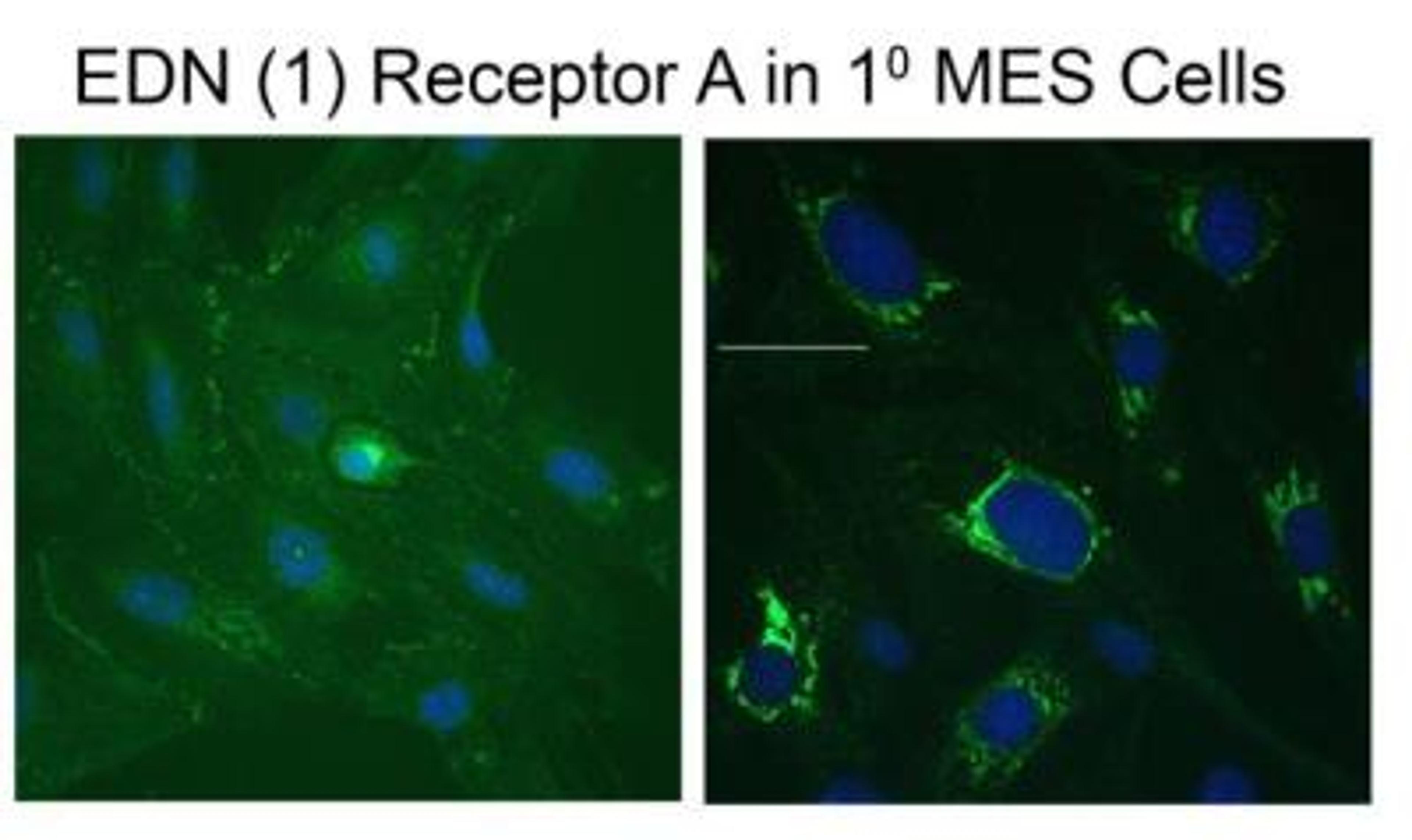 Immunocytochemistry/Immunofluorescence: EDNRA/Endothelin R Type A Antibody [NB600-836] - EDN 1 Receptor A in 1 MES Cells. Immunofluorescent staining image provided by verified customer review.