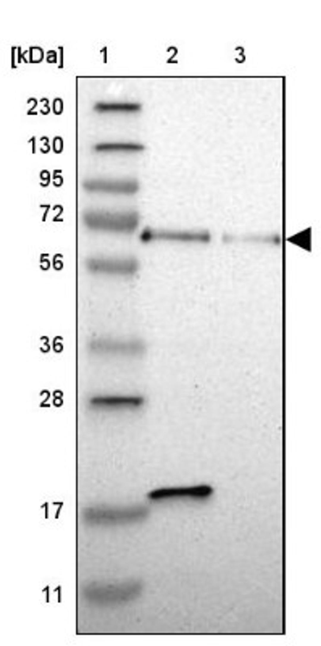 Western Blot: ACBD5 Antibody [NBP1-85146] - Lane 1: Marker [kDa] 230, 130, 95, 72, 56, 36, 28, 17, 11<br/>Lane 2: Human cell line RT-4<br/>Lane 3: Human cell line U-251MG sp