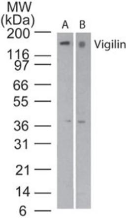 Western Blot: HDLBP Antibody [NBP2-24769] - analysis ofVigilin in A)Jurkat cell lysate and B)RAW cell lysate using this antibody. I goat anti-rabbit Ig HRP secondary antibody and PicoTect ECL substrate solution were used for this test.