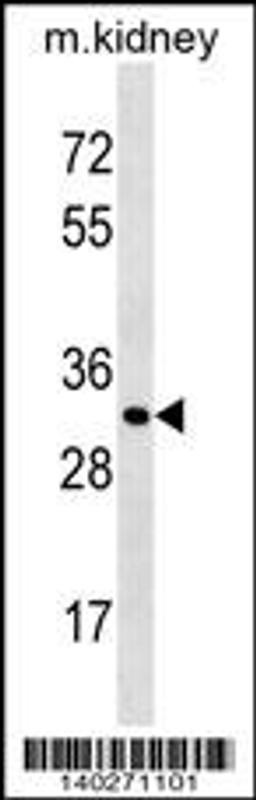 Western blot analysis in mouse kidney tissue lysates (35ug/lane).