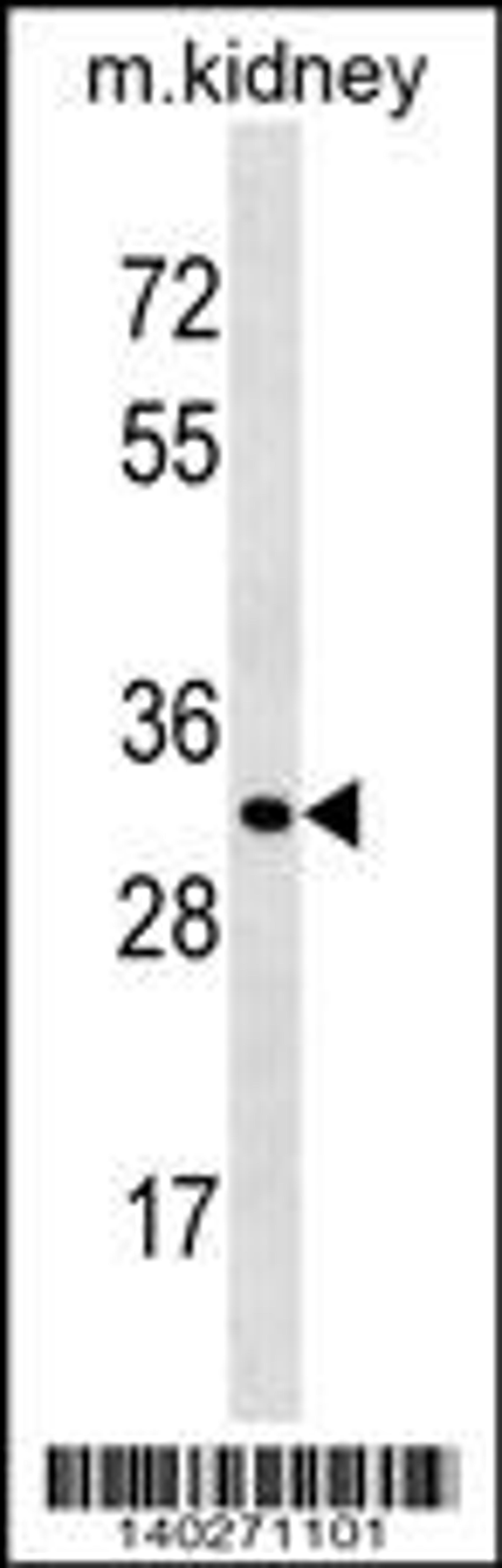 Western blot analysis in mouse kidney tissue lysates (35ug/lane).