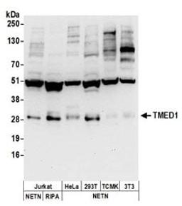 Detection of human and mouse TMED1 by western blot.