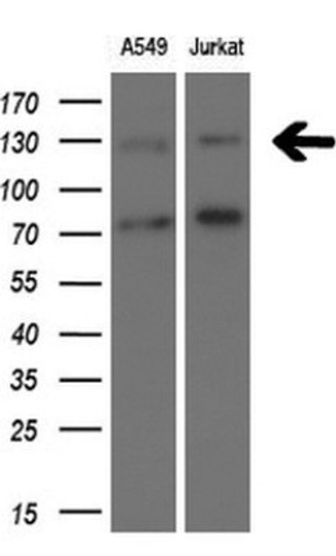 Western Blot: TSC1 Antibody (3A2) [NBP2-46234] - Analysis of extracts (10ug) from 2 different cell lines.