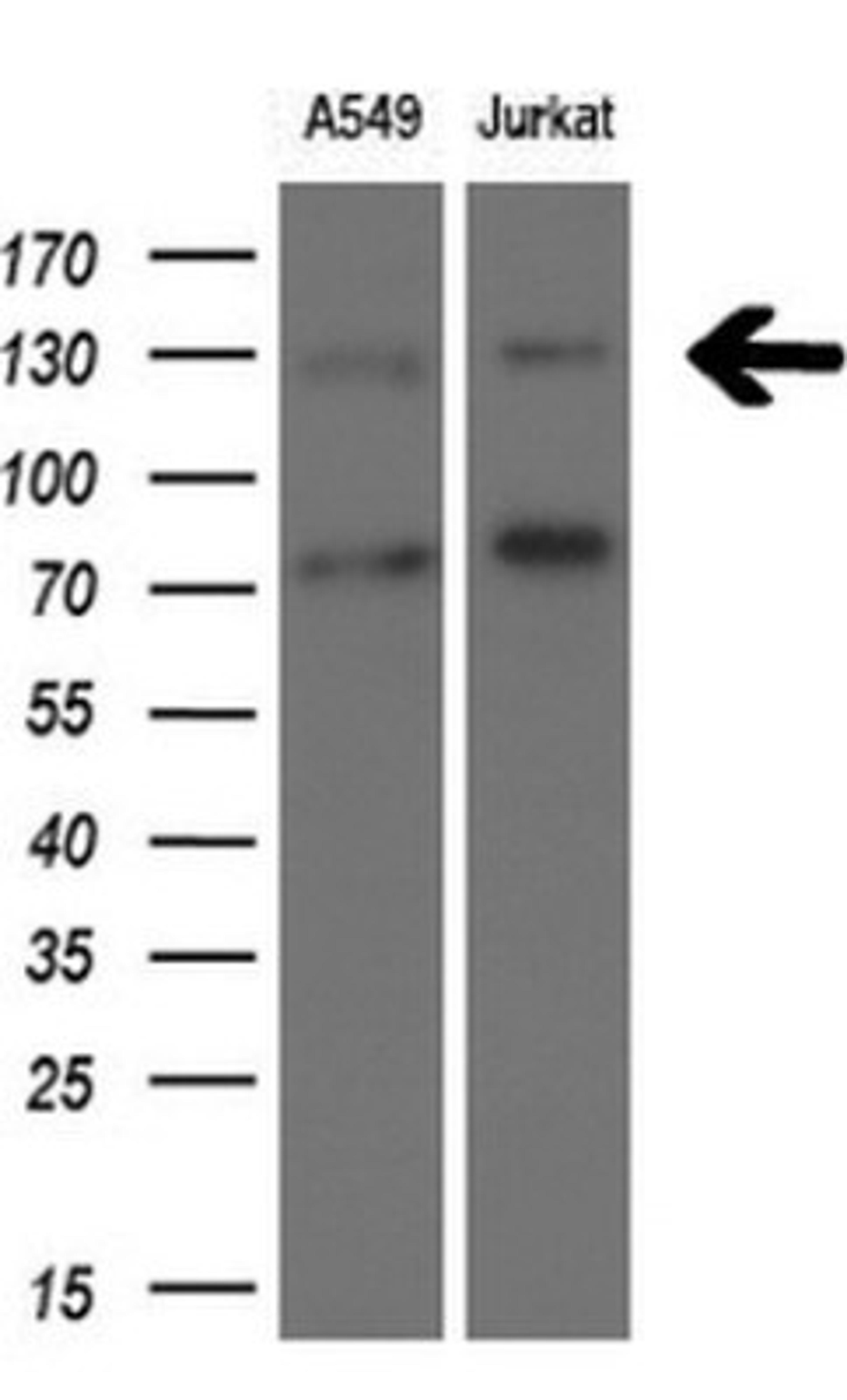 Western Blot: TSC1 Antibody (3A2) [NBP2-46234] - Analysis of extracts (10ug) from 2 different cell lines.