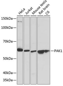 Western blot - PAK1 antibody (A19608)