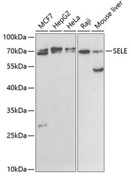 Western blot - SELE antibody (A2191)