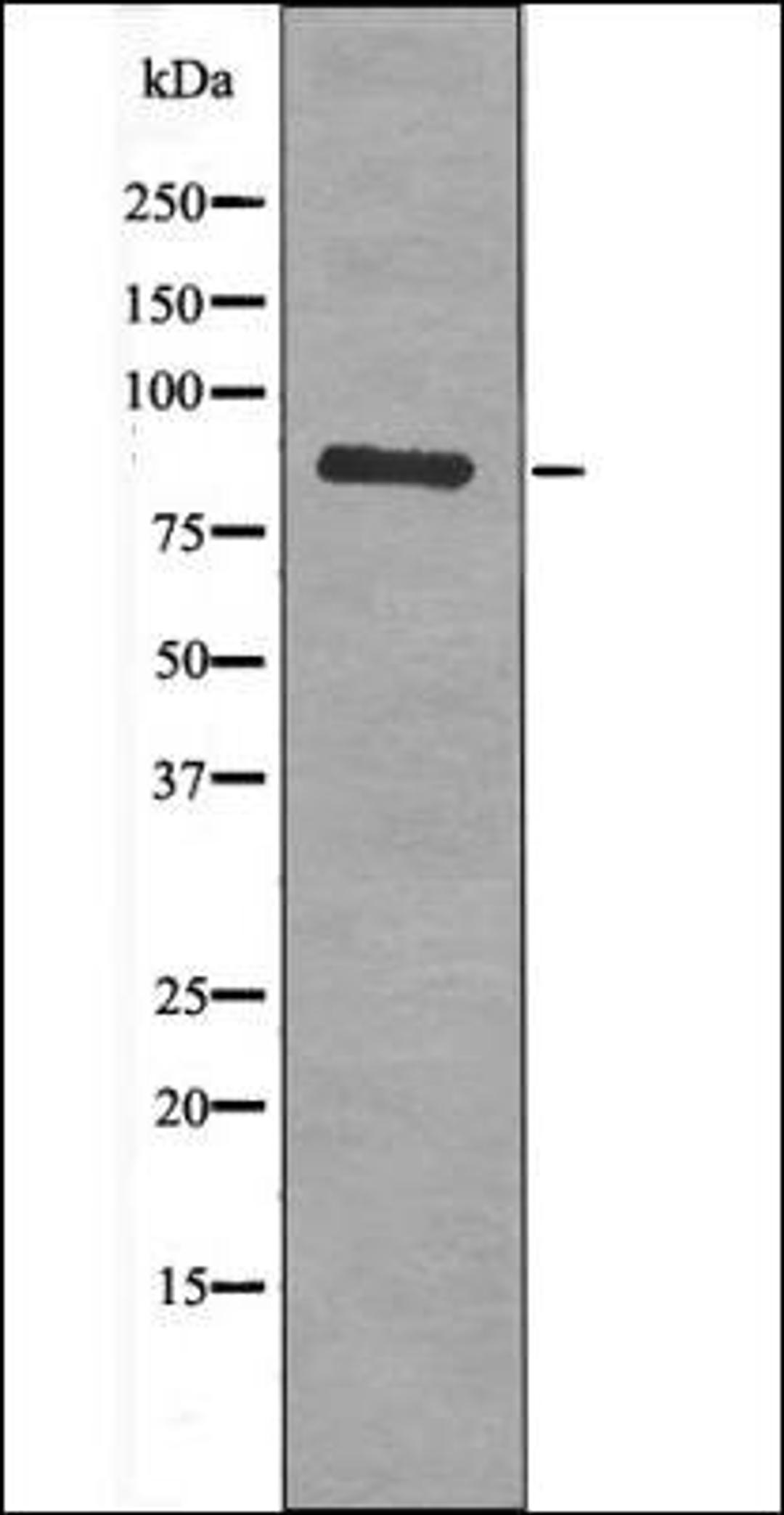 Western blot analysis of MCF7 whole cell lysates using PKG2 -Phospho-Ser126- antibody