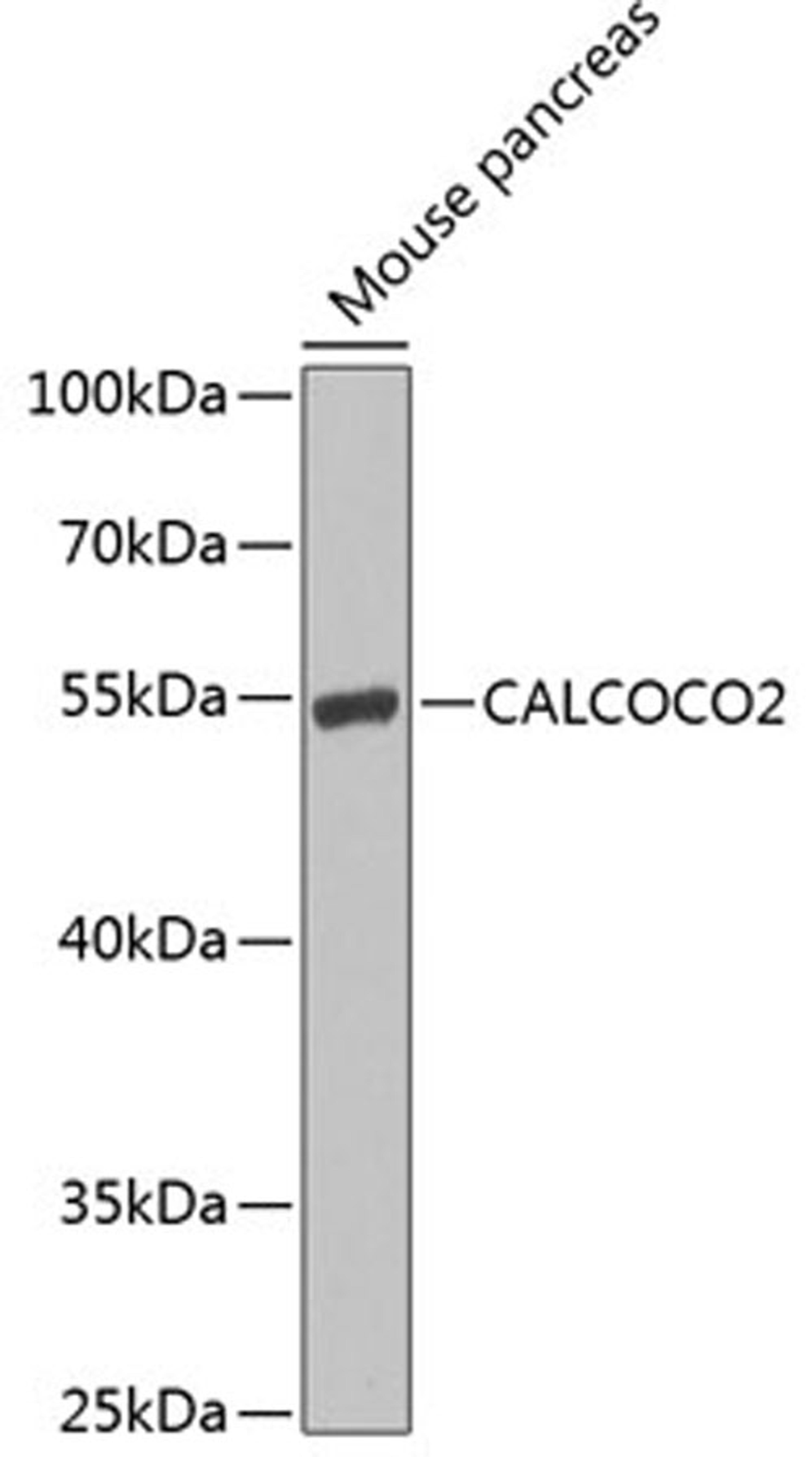 Western blot - CALCOCO2 antibody (A7358)