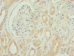 Immunohistochemistry of paraffin-embedded human kidney tissue using CSB-PA007648LA01HU at dilution of 1:100