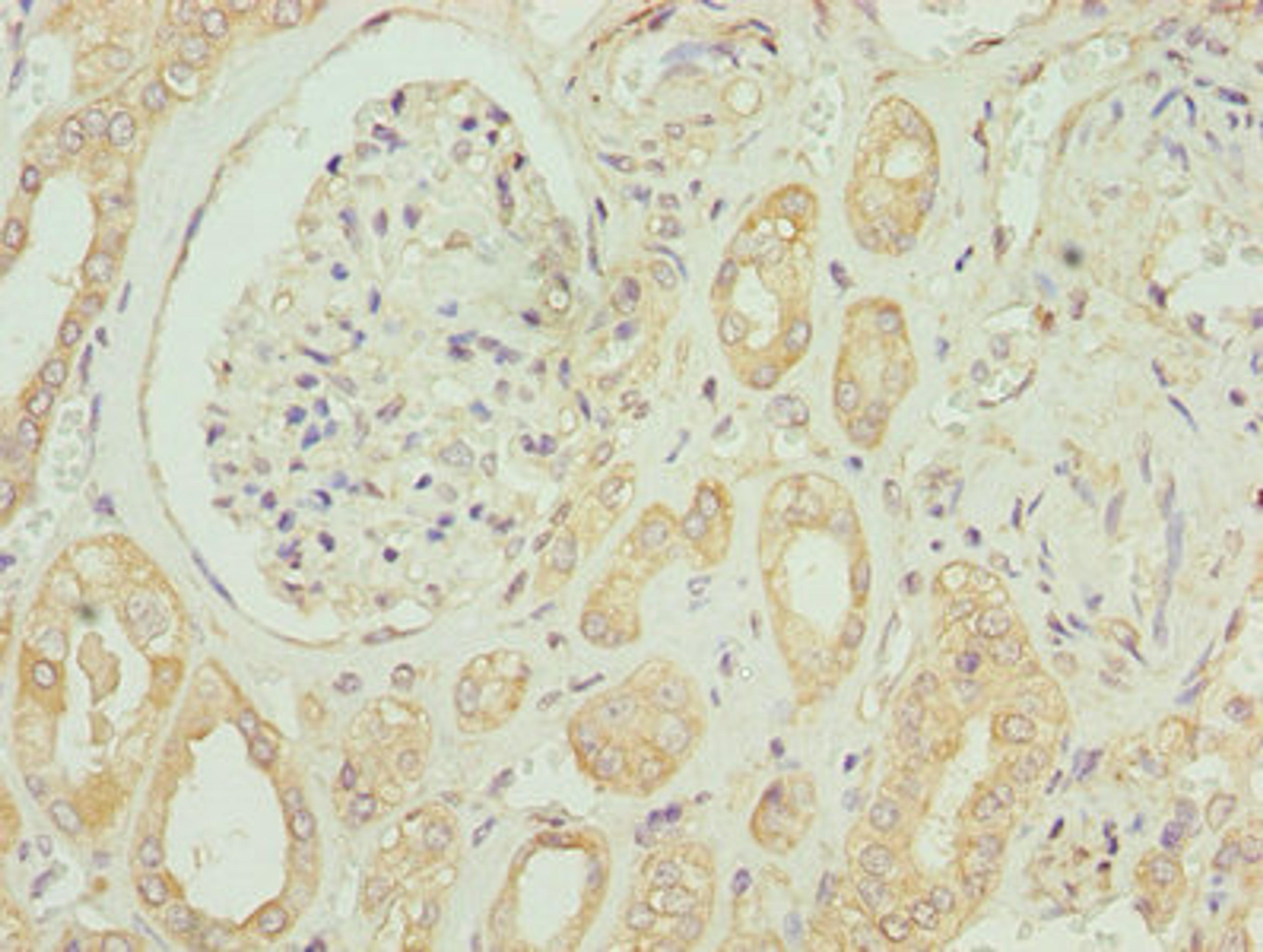 Immunohistochemistry of paraffin-embedded human kidney tissue using CSB-PA007648LA01HU at dilution of 1:100