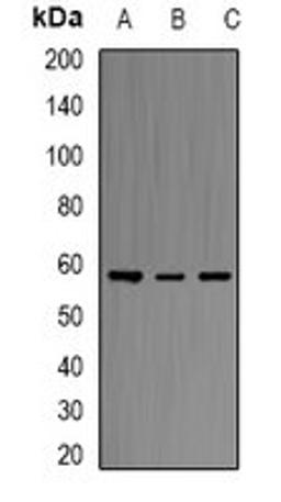 Western blot analysis of MCF7 (Lane1), THP1 (Lane2), Hela (Lane3) whole cell lysates using ERG antibody