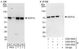 Detection of human DCP1A by western blot and immunoprecipitation.