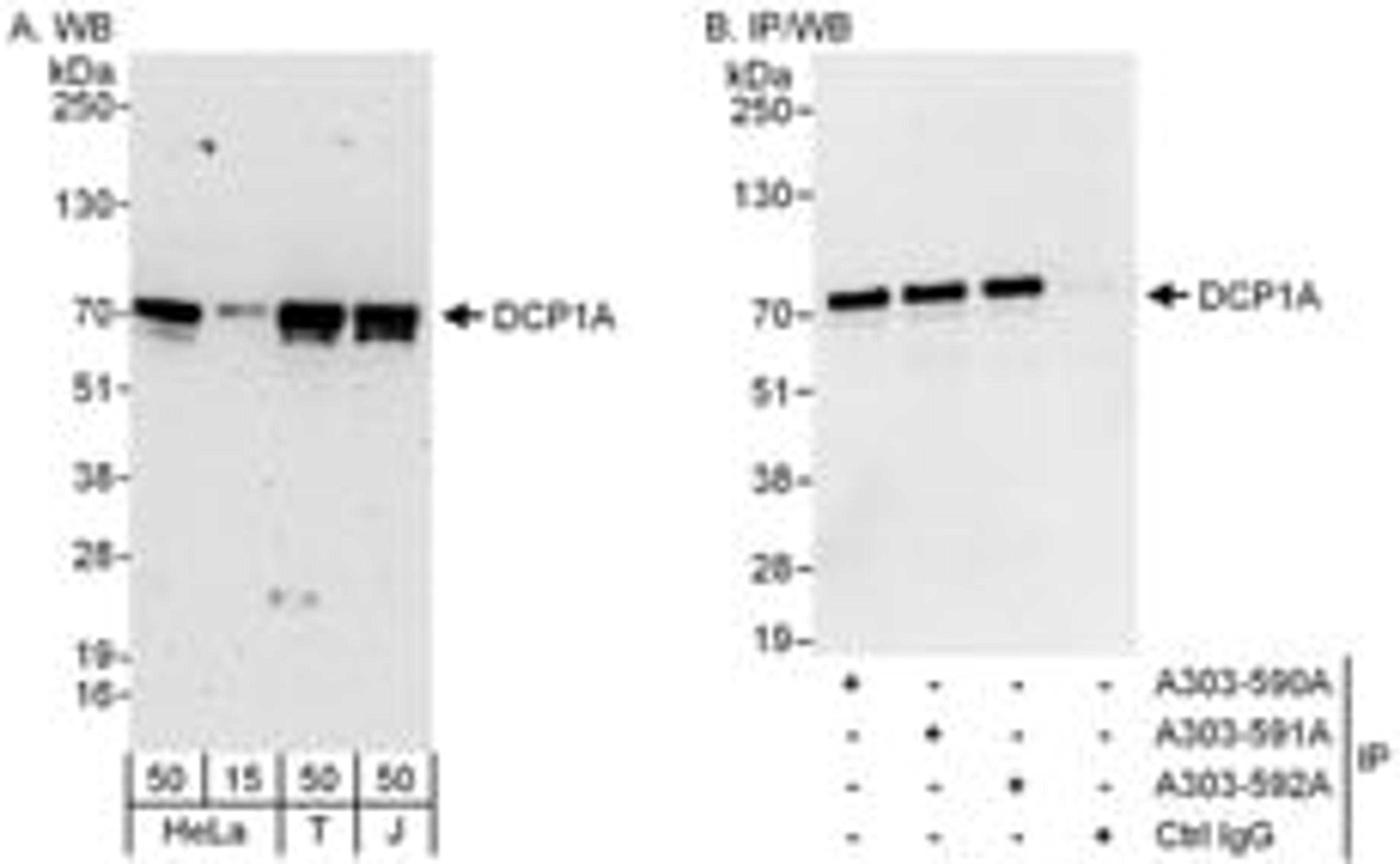 Detection of human DCP1A by western blot and immunoprecipitation.