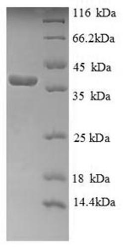 (Tris-Glycine gel) Discontinuous SDS-PAGE (reduced) with 5% enrichment gel and 15% separation gel.