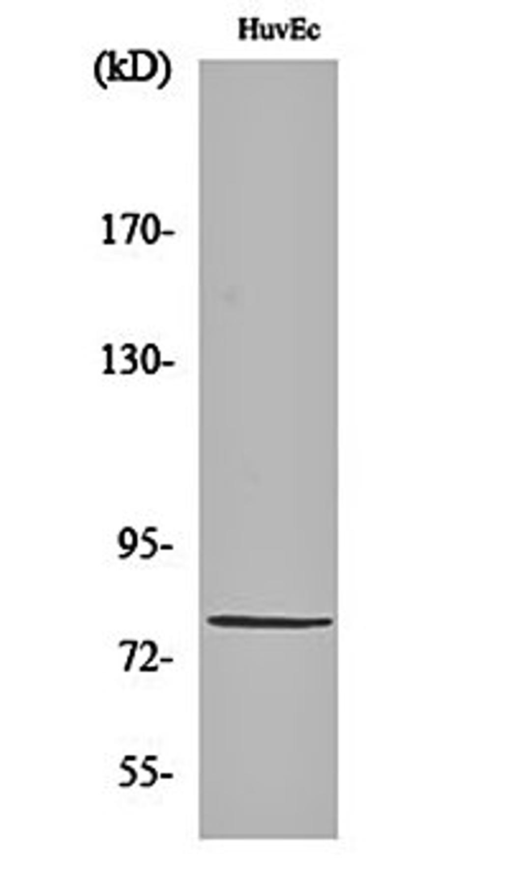 Western blot analysis of HuvEc cell lysates using PIAS 1 antibody