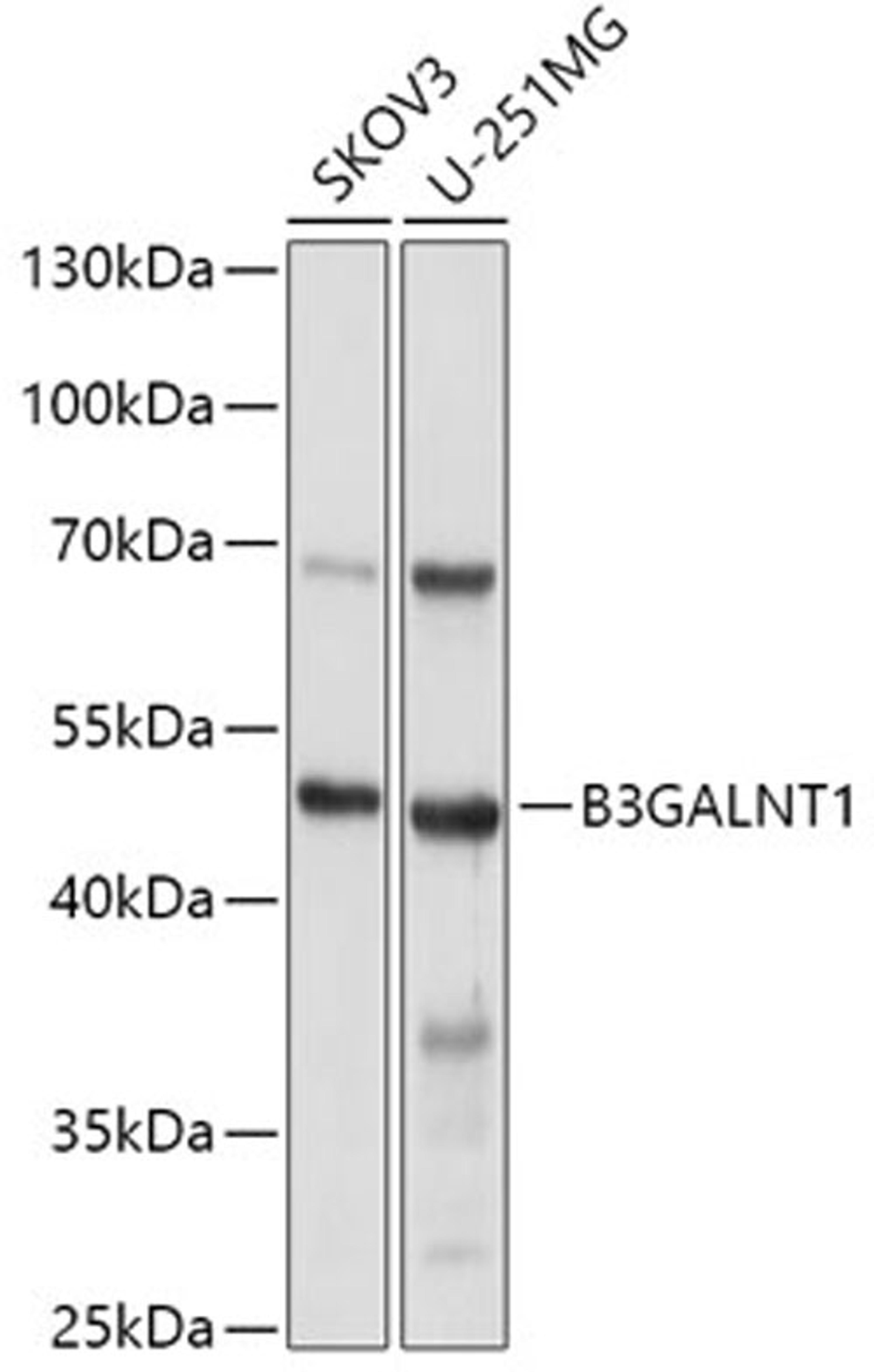 Western blot - B3GALNT1 antibody (A7755)