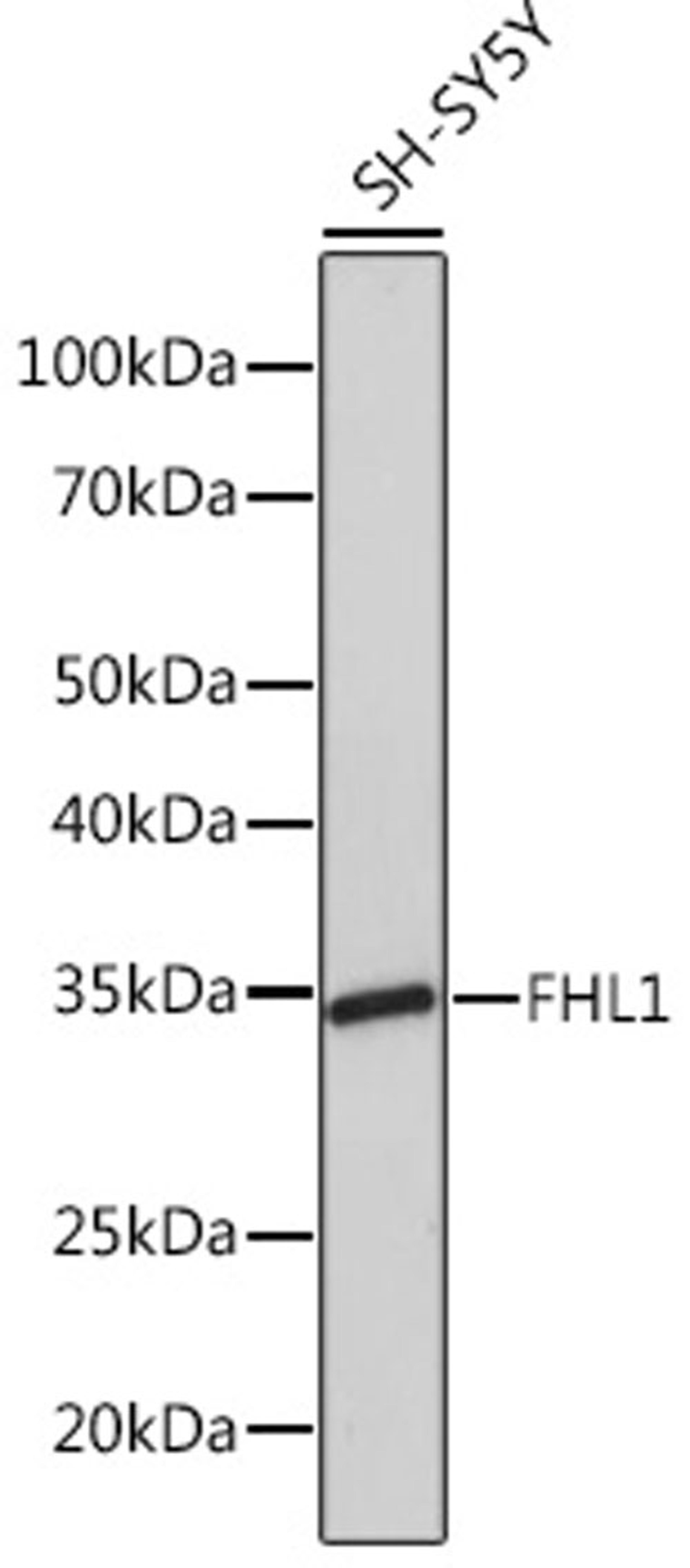 Western blot - FHL1 Rabbit mAb (A5018)