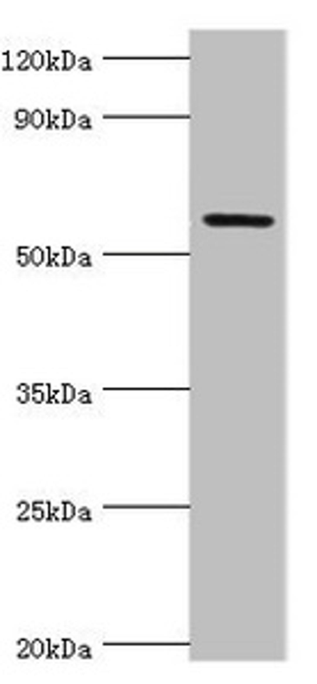 Western blot. All lanes: Growth factor receptor-bound protein 7 antibody at 2ug/ml + Rat brain tissue. Secondary. Goat polyclonal to rabbit IgG at 1/10000 dilution. Predicted band size: 60, 50, 63, 56 kDa. Observed band size: 60 kDa.