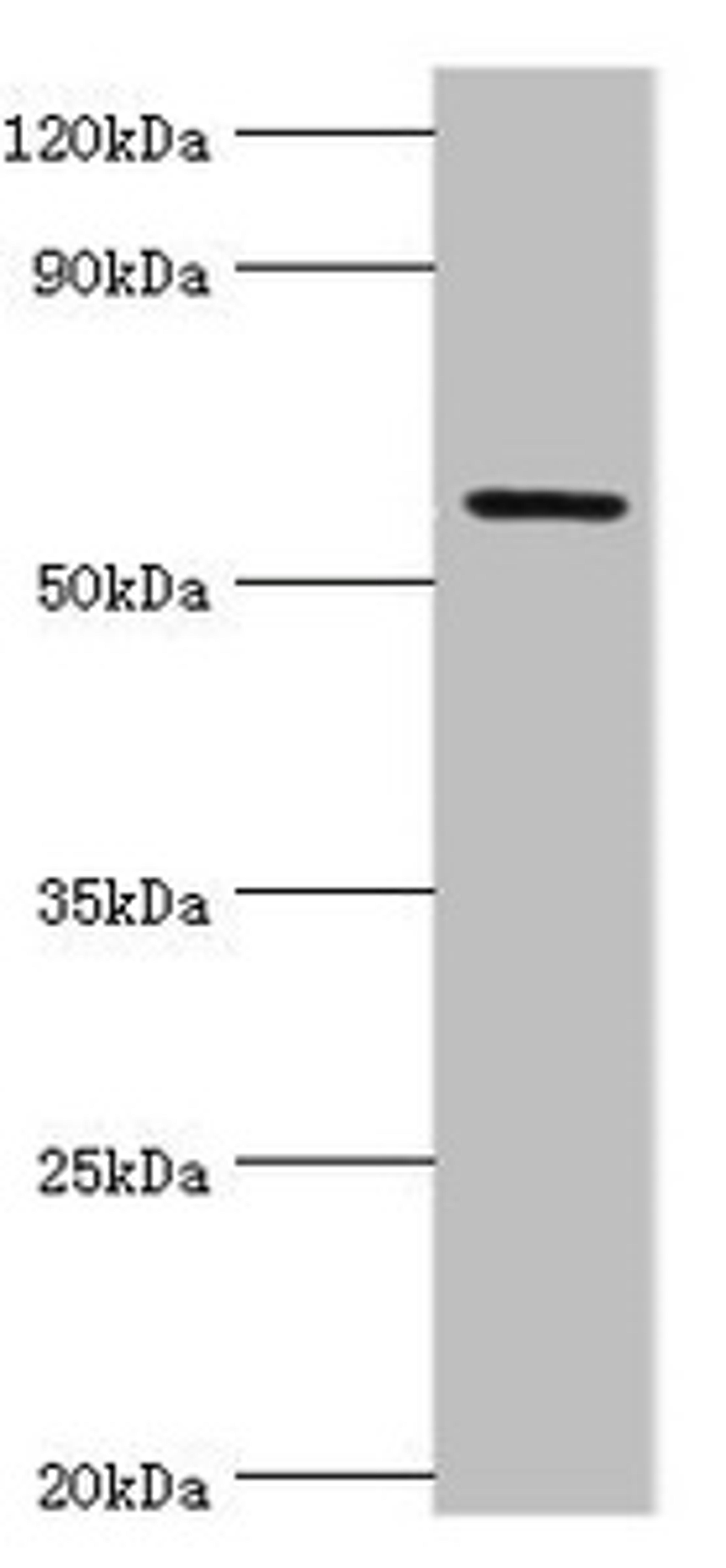 Western blot. All lanes: Growth factor receptor-bound protein 7 antibody at 2ug/ml + Rat brain tissue. Secondary. Goat polyclonal to rabbit IgG at 1/10000 dilution. Predicted band size: 60, 50, 63, 56 kDa. Observed band size: 60 kDa.