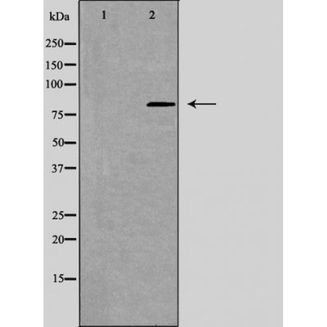 Western blot analysis of K562 cells and A549 cells using CSRL1 antibody