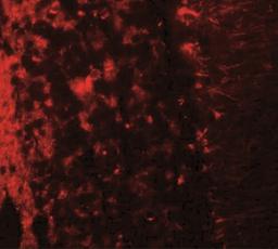 Immunocytochemistry/Immunofluorescence: LRRTM2 Antibody [NBP2-41129] - Immunofluorescence of LRRTM2 in human brain tissue with LRRTM2 antibody at 20 ug/mL.