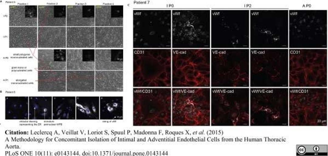 Sheep anti Human von Willebrand Factor antibody used to evaluate von Willebrand factor expression