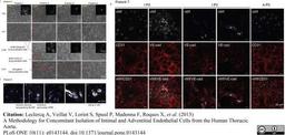 Sheep anti Human von Willebrand Factor antibody used to evaluate von Willebrand factor expression