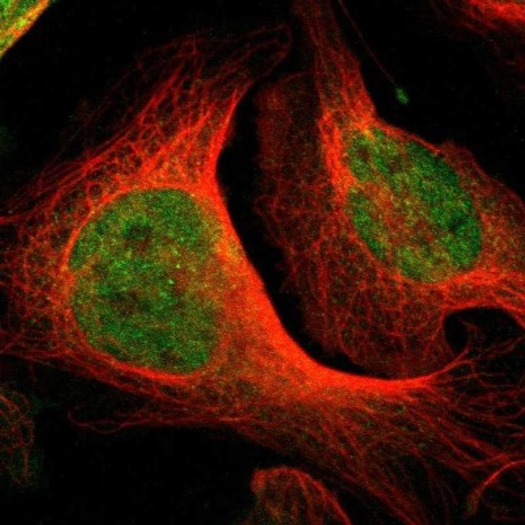 Immunocytochemistry/Immunofluorescence: DHRS1 Antibody [NBP1-83560] - Staining of human cell line U-2 OS shows positivity in nucleus but not nucleoli & cytoplasm.