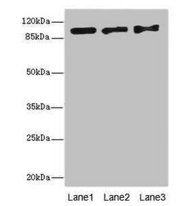 Western blot. All lanes: EXO1 antibody at 10ug/ml. Lane 1: Hela whole cell lysate. Lane 2: 293T whole cell lysate. Lane 3: A549 whole cell lysate. Secondary. Goat polyclonal to rabbit IgG at 1/10000 dilution. Predicted band size: 95, 90 kDa. Observed band size: 95 kDa. 
