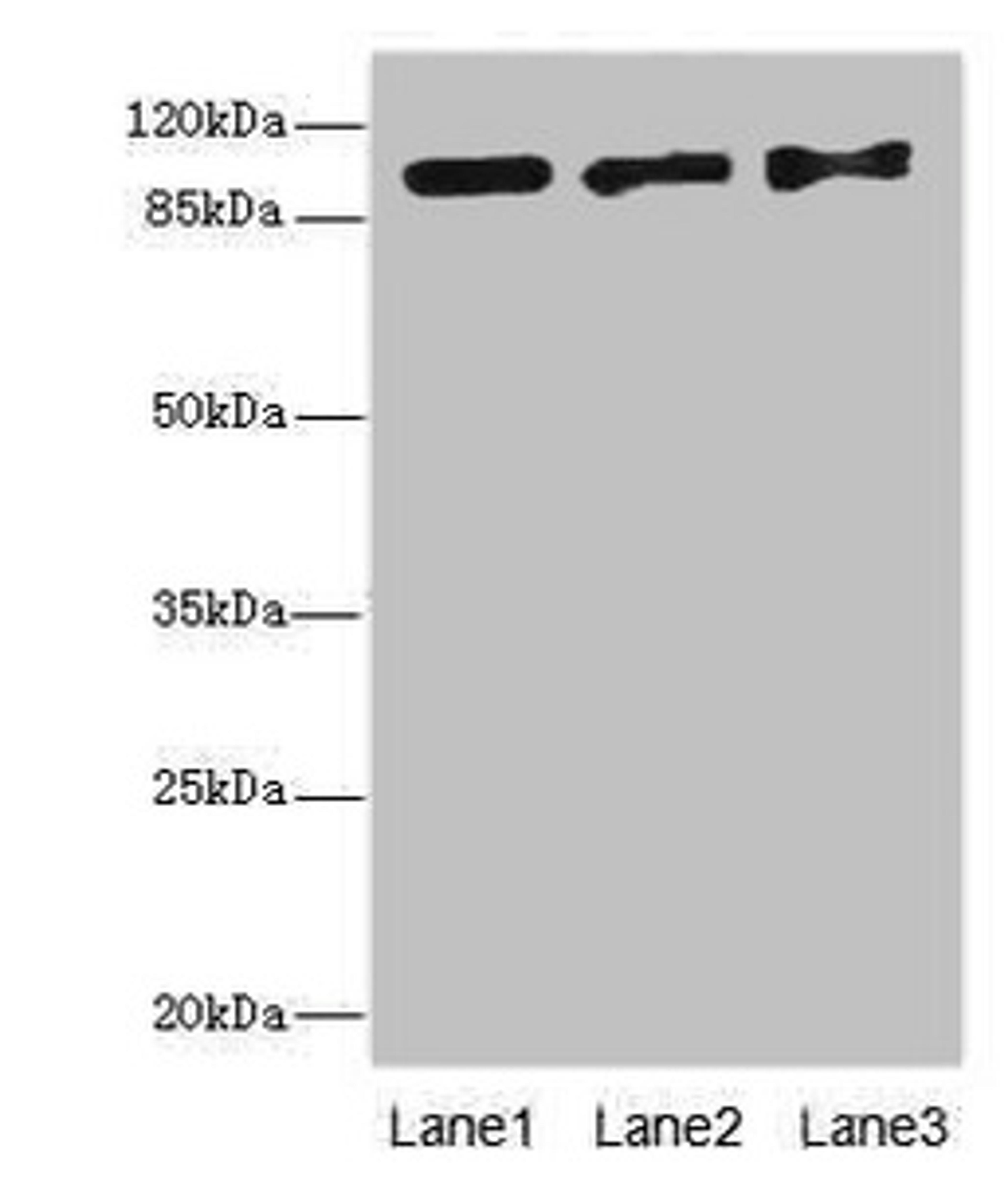 Western blot. All lanes: EXO1 antibody at 10ug/ml. Lane 1: Hela whole cell lysate. Lane 2: 293T whole cell lysate. Lane 3: A549 whole cell lysate. Secondary. Goat polyclonal to rabbit IgG at 1/10000 dilution. Predicted band size: 95, 90 kDa. Observed band size: 95 kDa. 