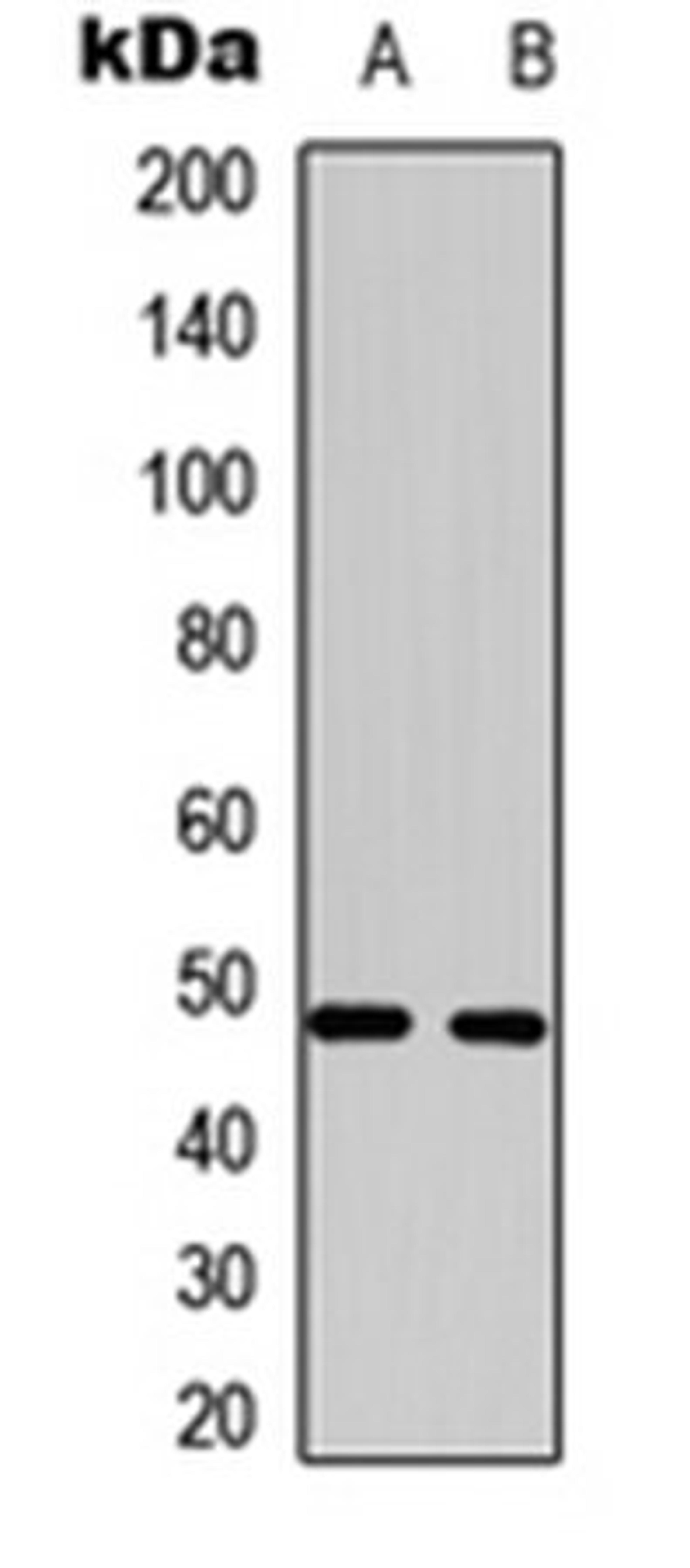 Western blot analysis of HepG2 (Lane 1), Hela (Lane 2) whole cell lysates using MCT14 antibody