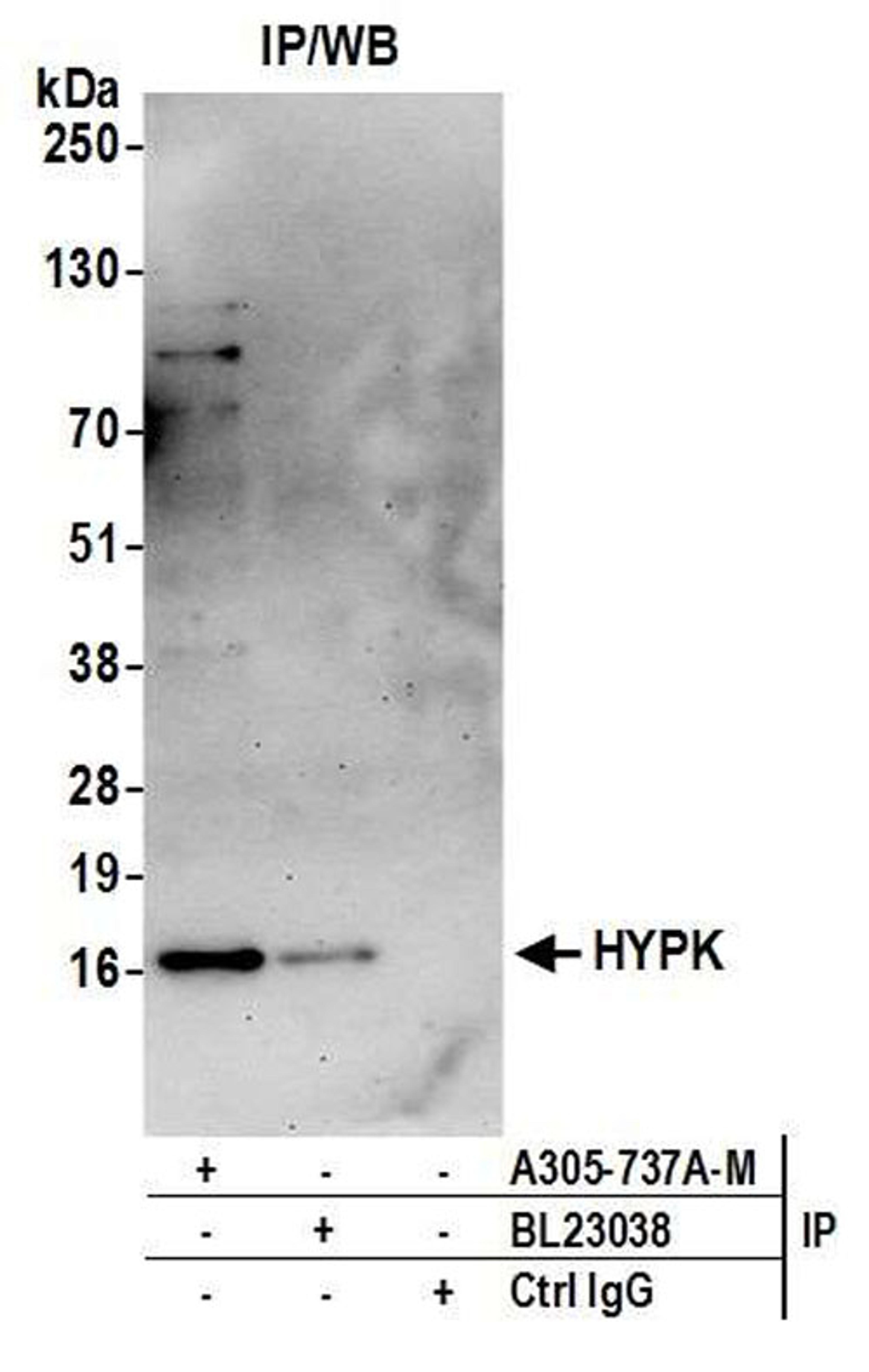 Detection of human HYPK by WB of IP.