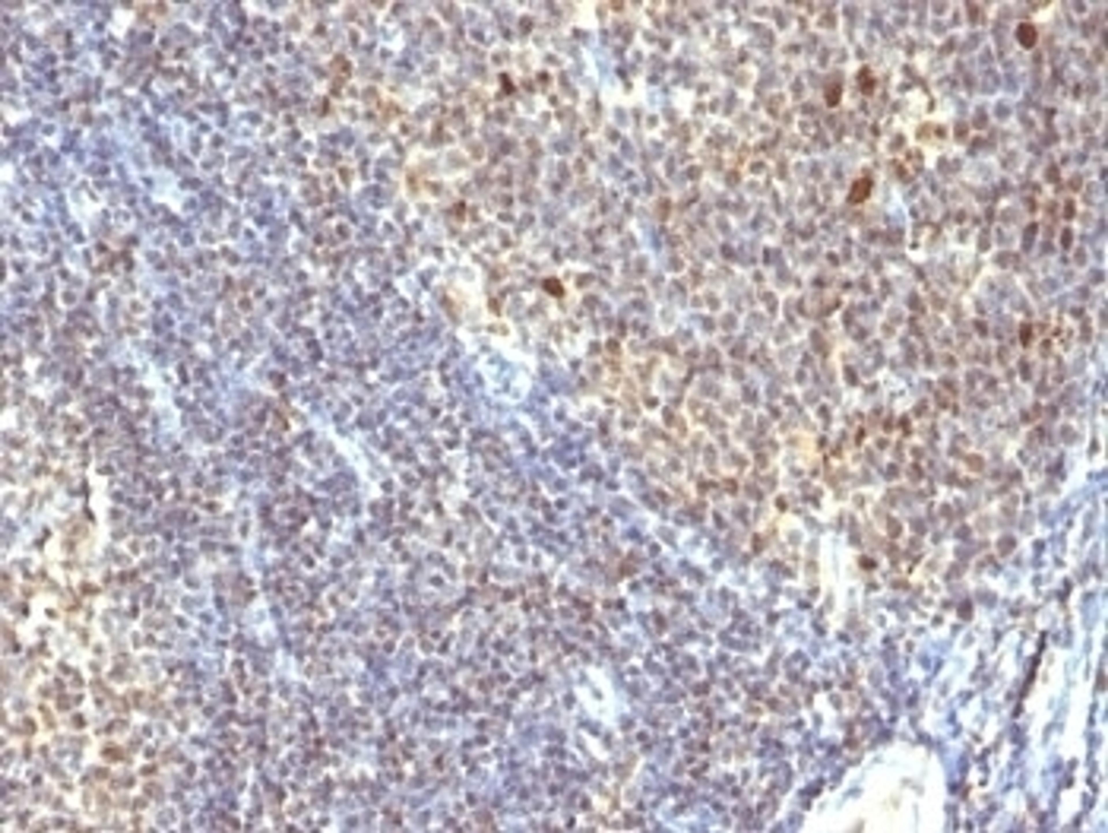 Formalin-fixed, paraffin-embedded human tonsil stained with IPO38 antibody (SPM260).