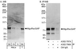 Detection of human MgcRacGAP by western blot and immunoprecipitation.