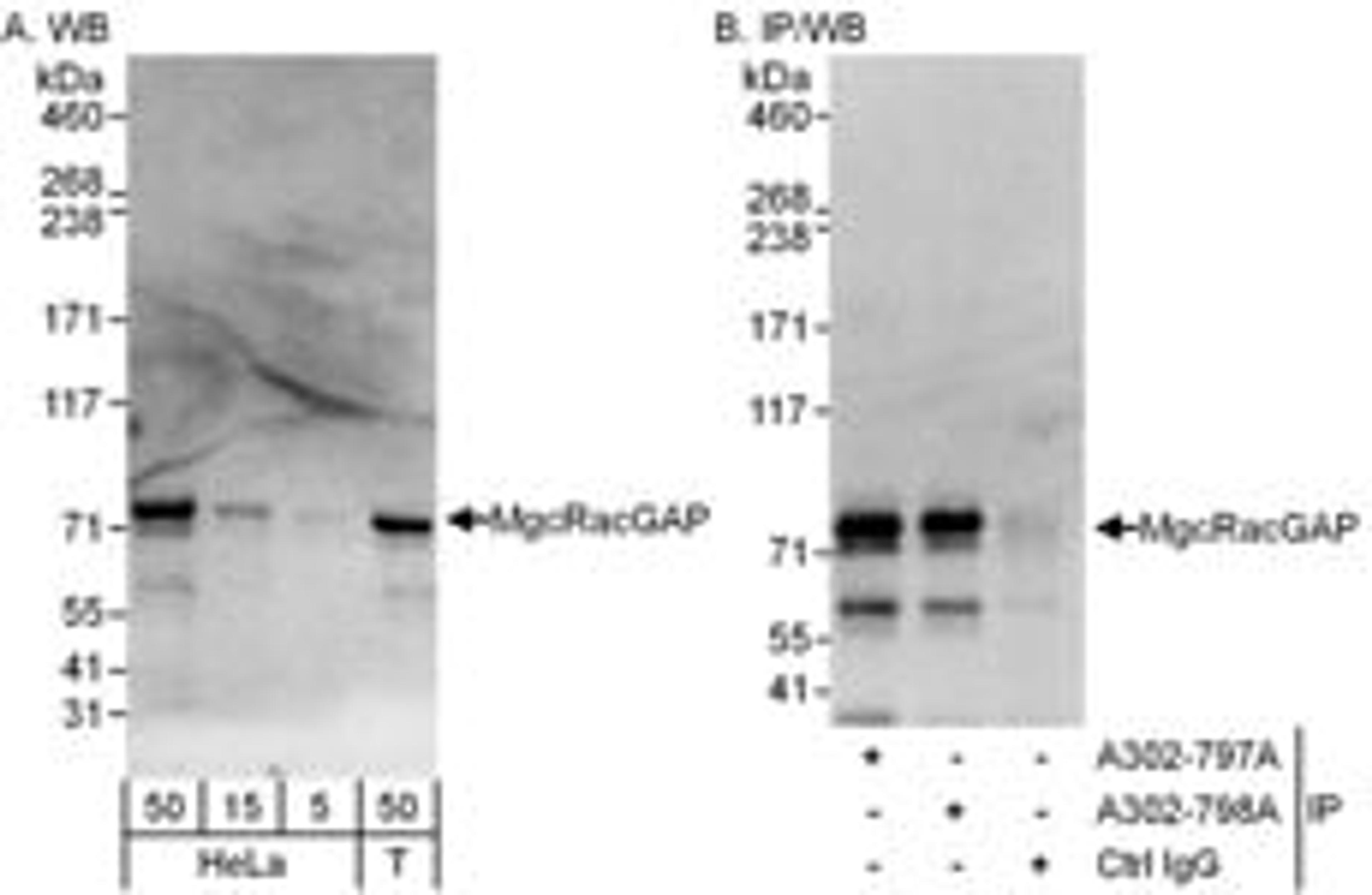 Detection of human MgcRacGAP by western blot and immunoprecipitation.