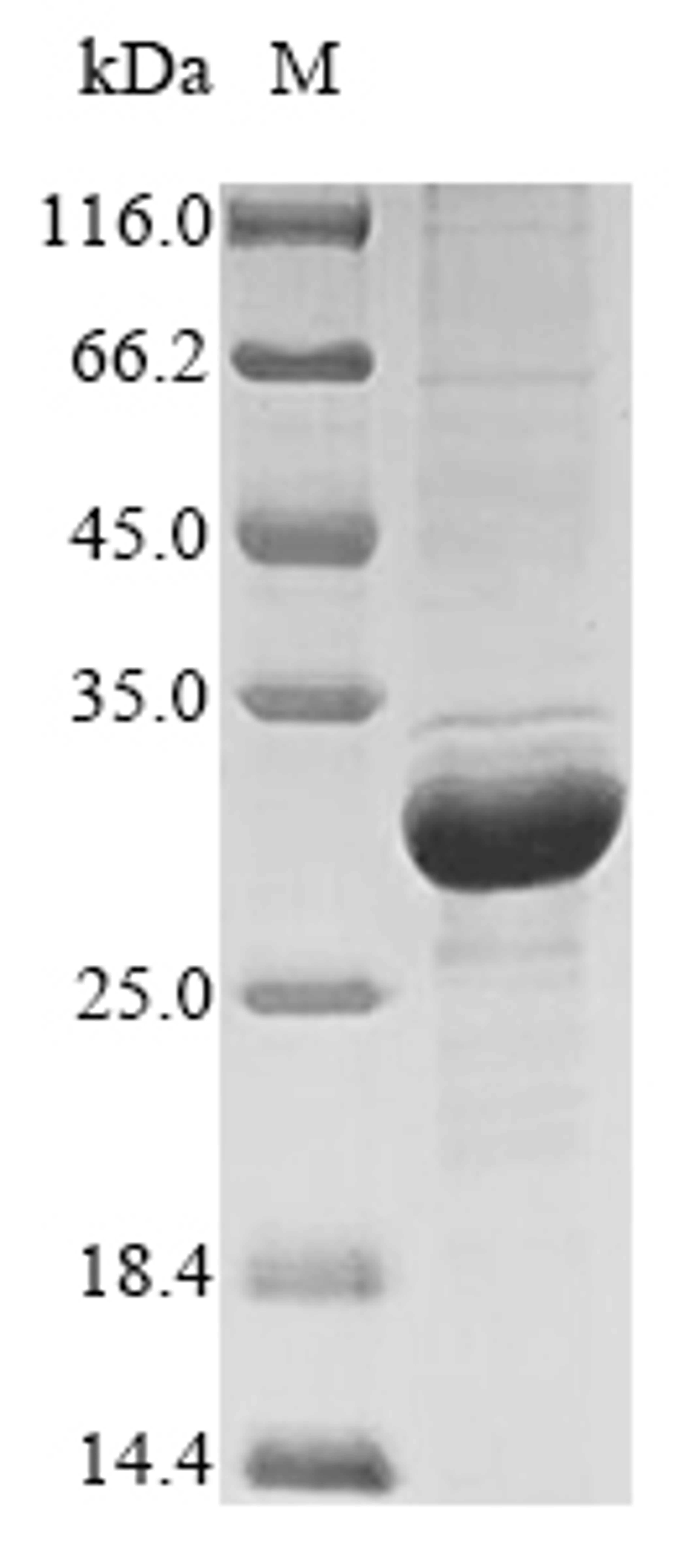(Tris-Glycine gel) Discontinuous SDS-PAGE (reduced) with 5% enrichment gel and 15% separation gel.