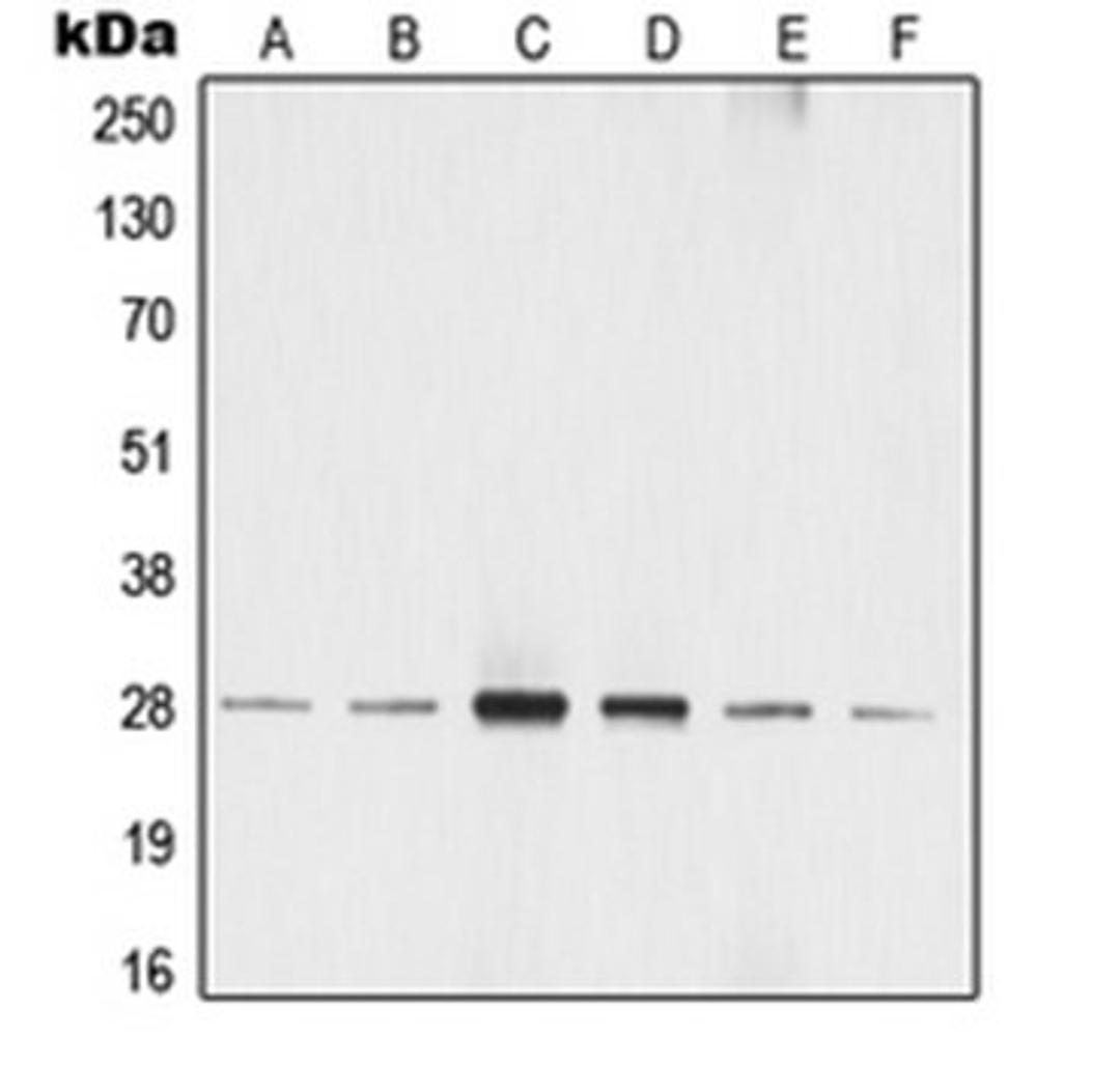 Western blot analysis of MCF7 (Lane 1), A549 (Lane 2), SP2/0 (Lane 3), rat liver (Lane 4), NIH3T3 (Lane 5), A431 (Lane 6) whole cell lysates using YWHAZ antibody