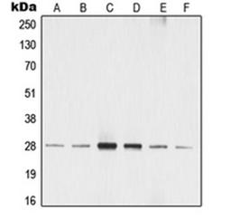 Western blot analysis of MCF7 (Lane 1), A549 (Lane 2), SP2/0 (Lane 3), rat liver (Lane 4), NIH3T3 (Lane 5), A431 (Lane 6) whole cell lysates using YWHAZ antibody