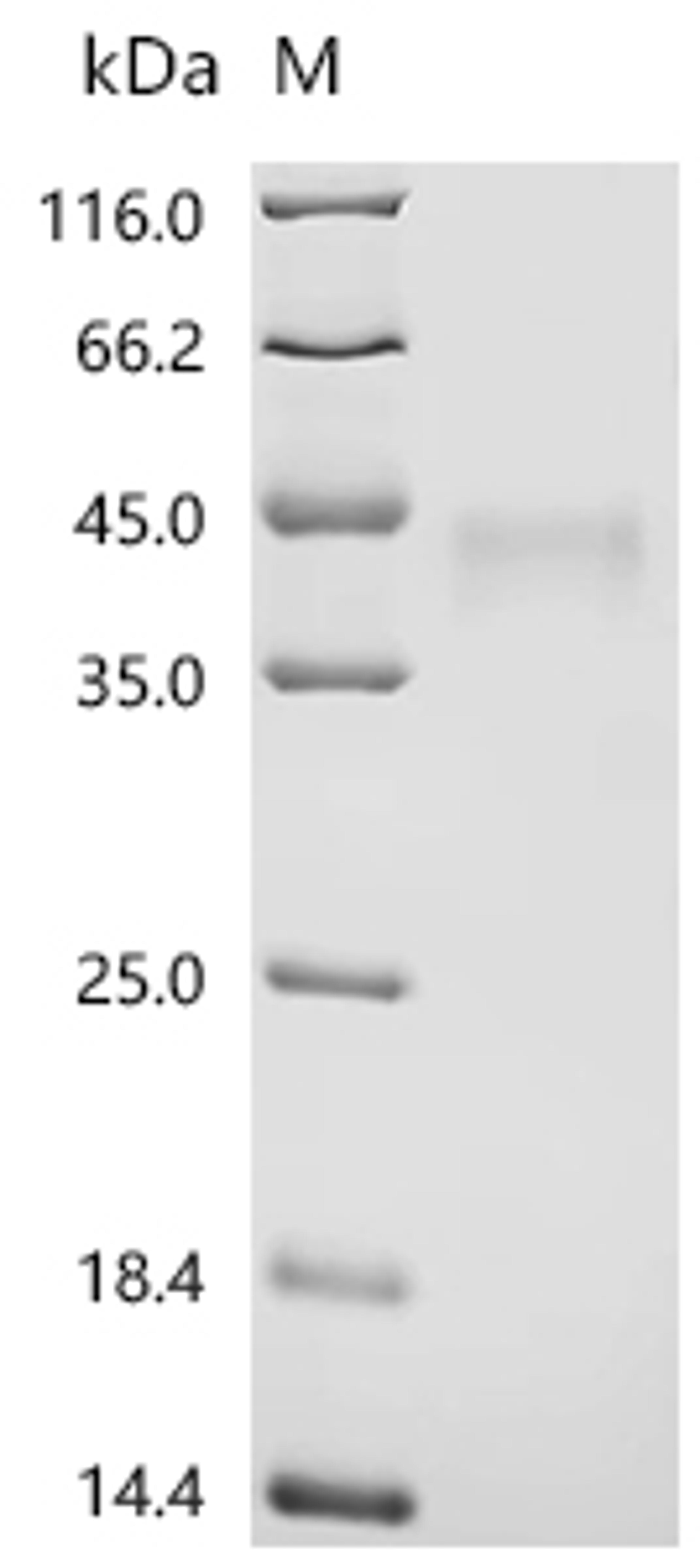 (Tris-Glycine gel) Discontinuous SDS-PAGE (reduced) with 5% enrichment gel and 15% separation gel.