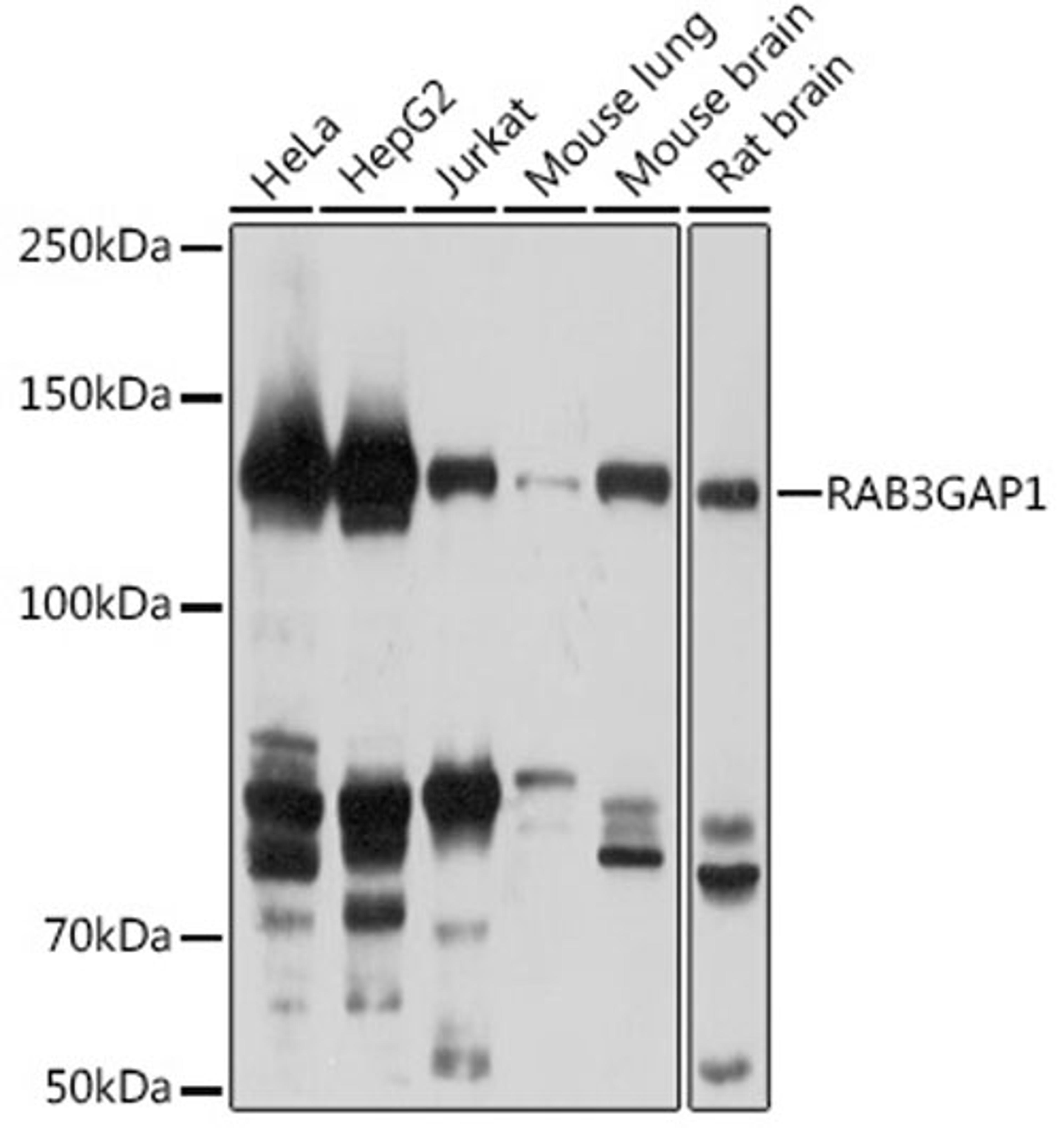 Western blot - RAB3GAP1 antibody (A18587)